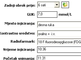 PET/CT podaci nalaza